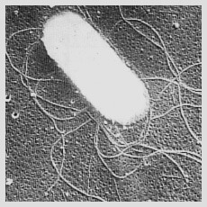大腸菌（O-157：H7）